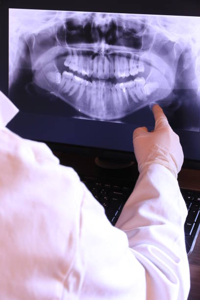 Best Broken or Chipped Tooth Repair in Erlanger, KY